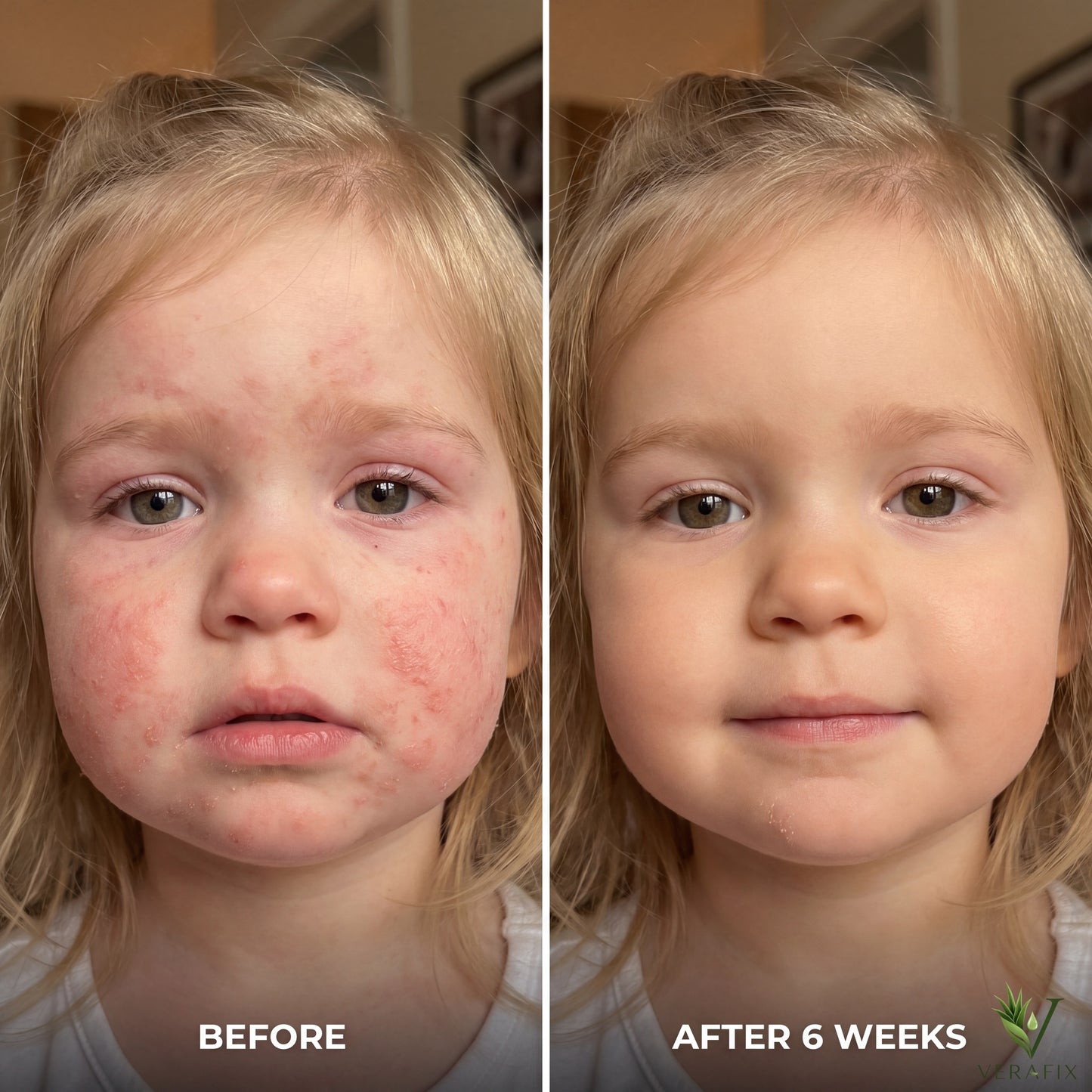 Verafix- Skin Repair Serum